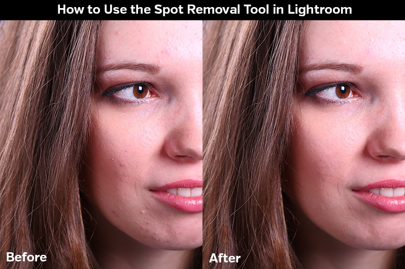 Spot Removal lightroom